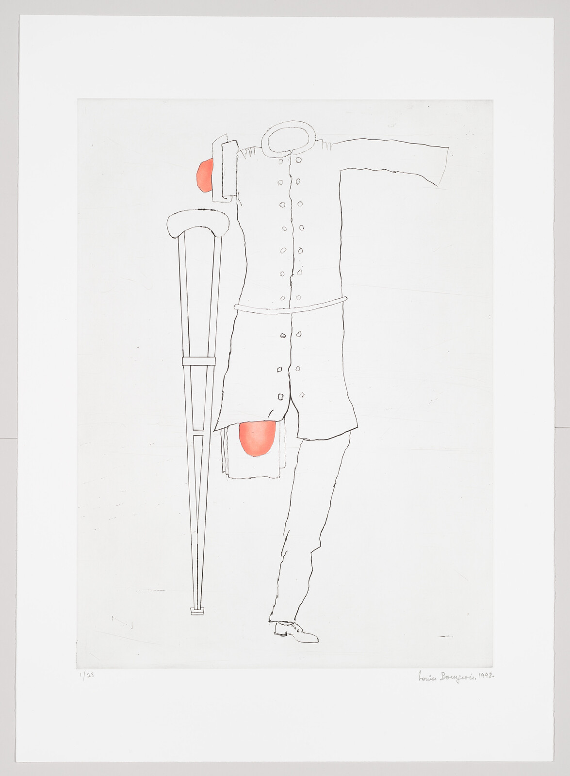 Sketch of a person with one crutch and a missing left leg, red patches at shoulder and thigh.