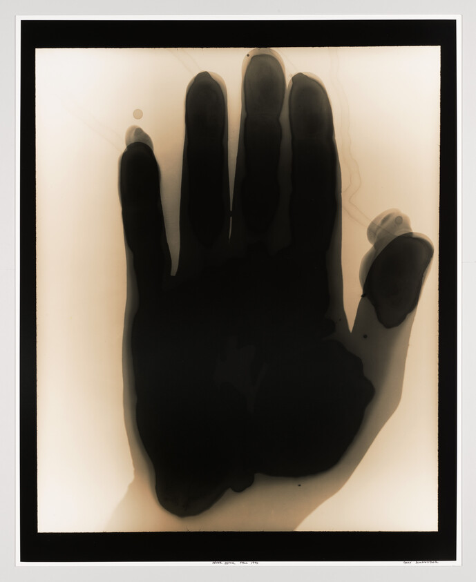 Dark x-ray style silhouette of a left hand with fingers spread against a light background.