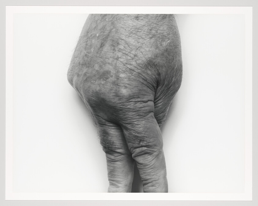 A wrist twisted to the left has two fingers that are standing, with the thumb bent behind it