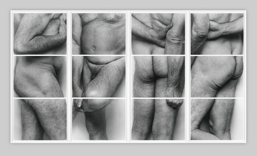 A black and white photo collage featuring close-up segments of a human body, including parts of the torso, limbs, and skin folds, displayed in a grid format.