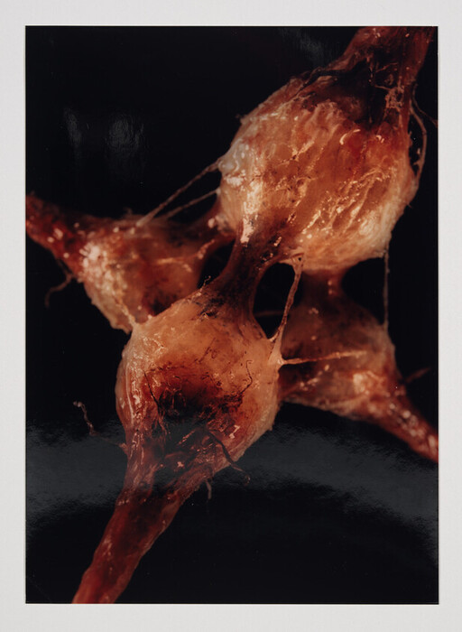Three reddish translucent blobs connected by thin fibrous strands against a black background.