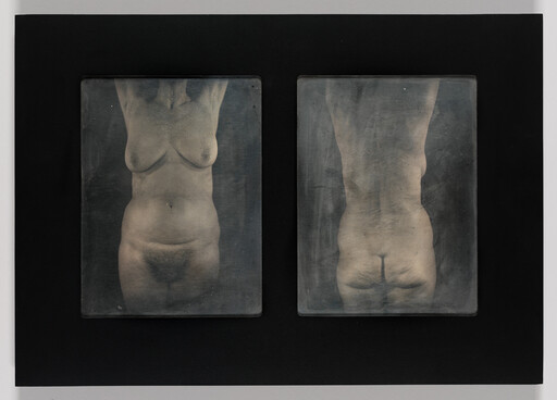 Two grayscale photographic plates showing a nude adult torso from front and back with arms raised.