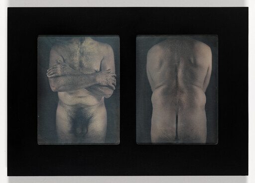 Two side-by-side plates show a nude adult torso from front with arms crossed and from the back.