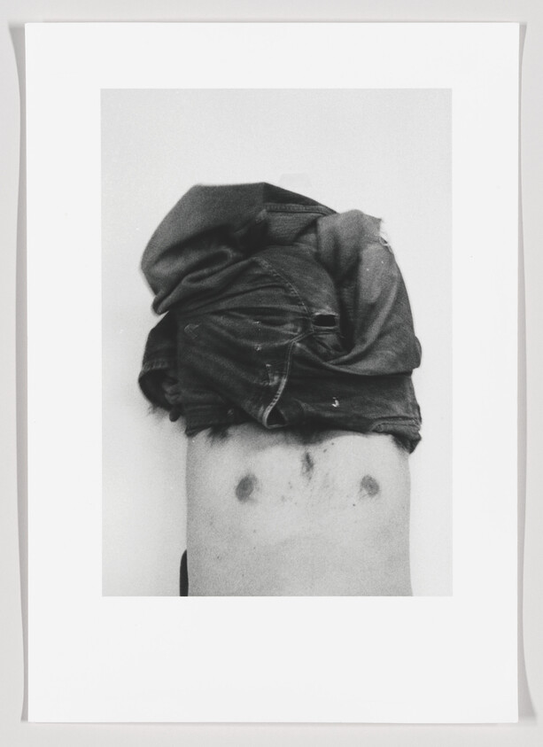 Person with shirt pulled over their head exposing a bare chest with two small circular marks.