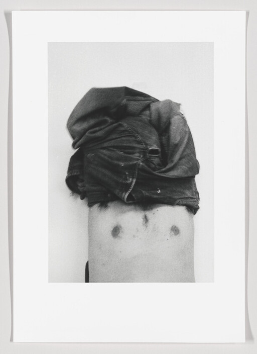 Person with shirt pulled over their head exposing a bare chest with two small circular marks.