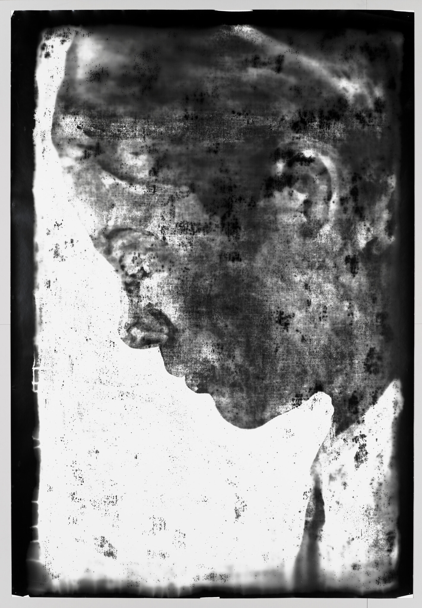 A grainy black-and-white side profile of a man looking downward with textured spots.