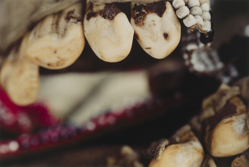 Close-up of yellowed, decayed teeth and bead decorations on an aged jaw.