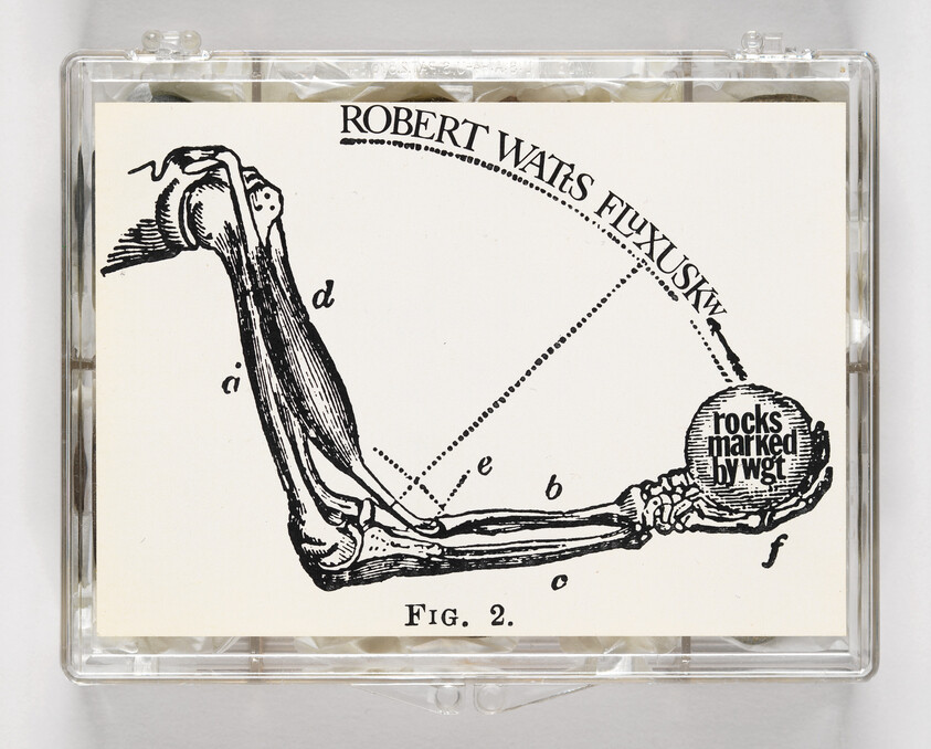 An anatomical drawing of a bent arm holding a ball labeled "rocks marked by wgt" with title above.