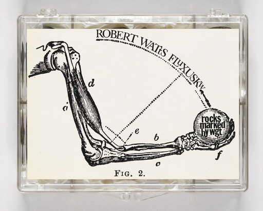 An anatomical drawing of a bent arm holding a ball labeled "rocks marked by wgt" with title above.