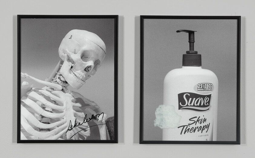 Framed wall art shows a human skeleton in one frame and a Suave Skin Therapy lotion bottle in the other.
