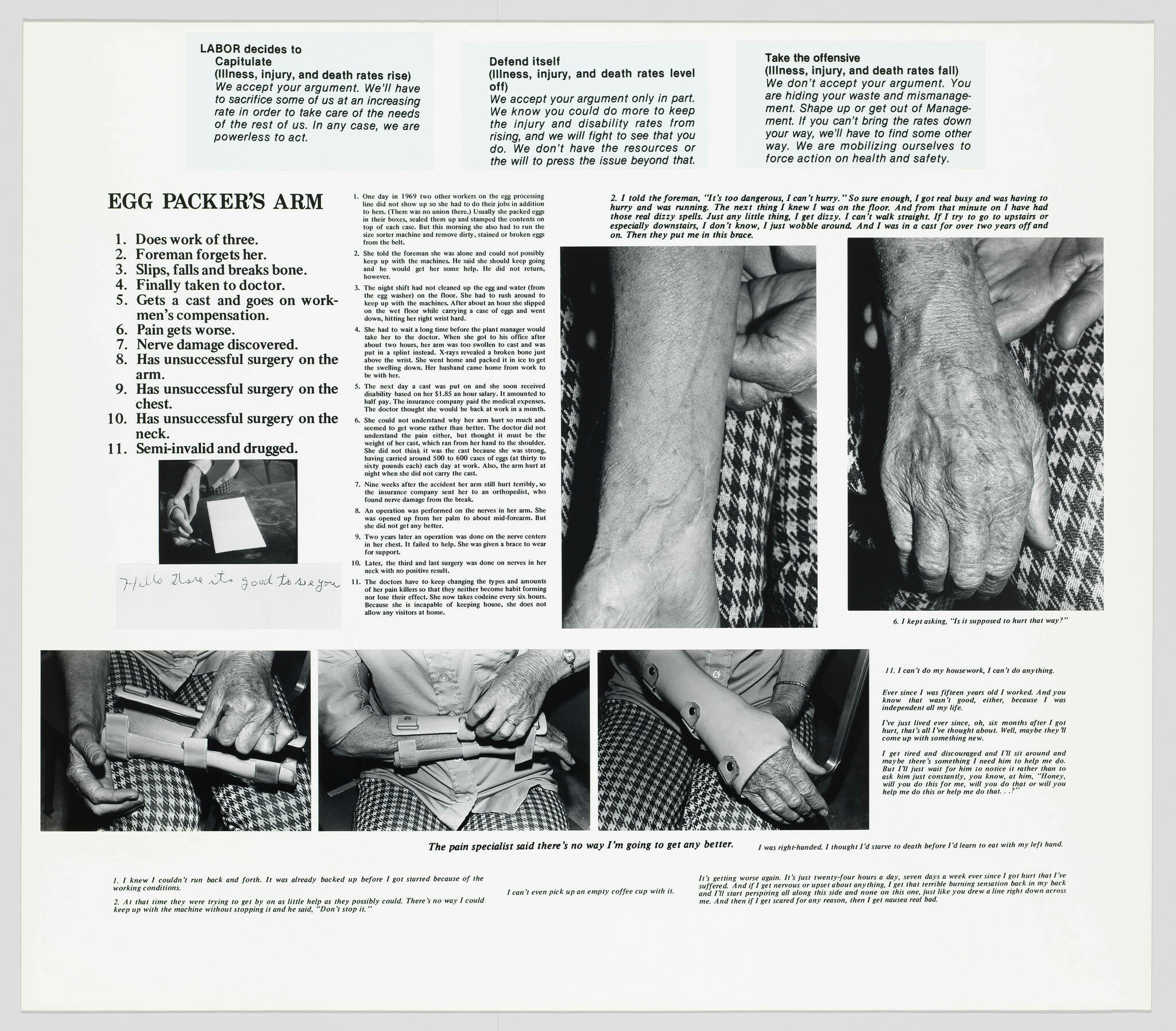 This image is a black and white collage of text and photographs that tell the story of an egg packer's arm injury. The left side of the image features a list titled "EGG PACKER'S ARM" with 11 points detailing the progression of the worker's injury and its consequences. The right side of the image contains three columns of text with headings "LABOR decides to," "Defend itself," and "Take the offensive," each discussing different perspectives on workplace injuries and safety. Interspersed between the texts are close-up photographs of an elderly person's hands and arms, showing the physical effects of the injury, such as bandages and deformity. There is also an image of the person attempting to button a shirt, illustrating the difficulty they face with everyday tasks. Handwritten text at the bottom left corner appears to be a signature or note.