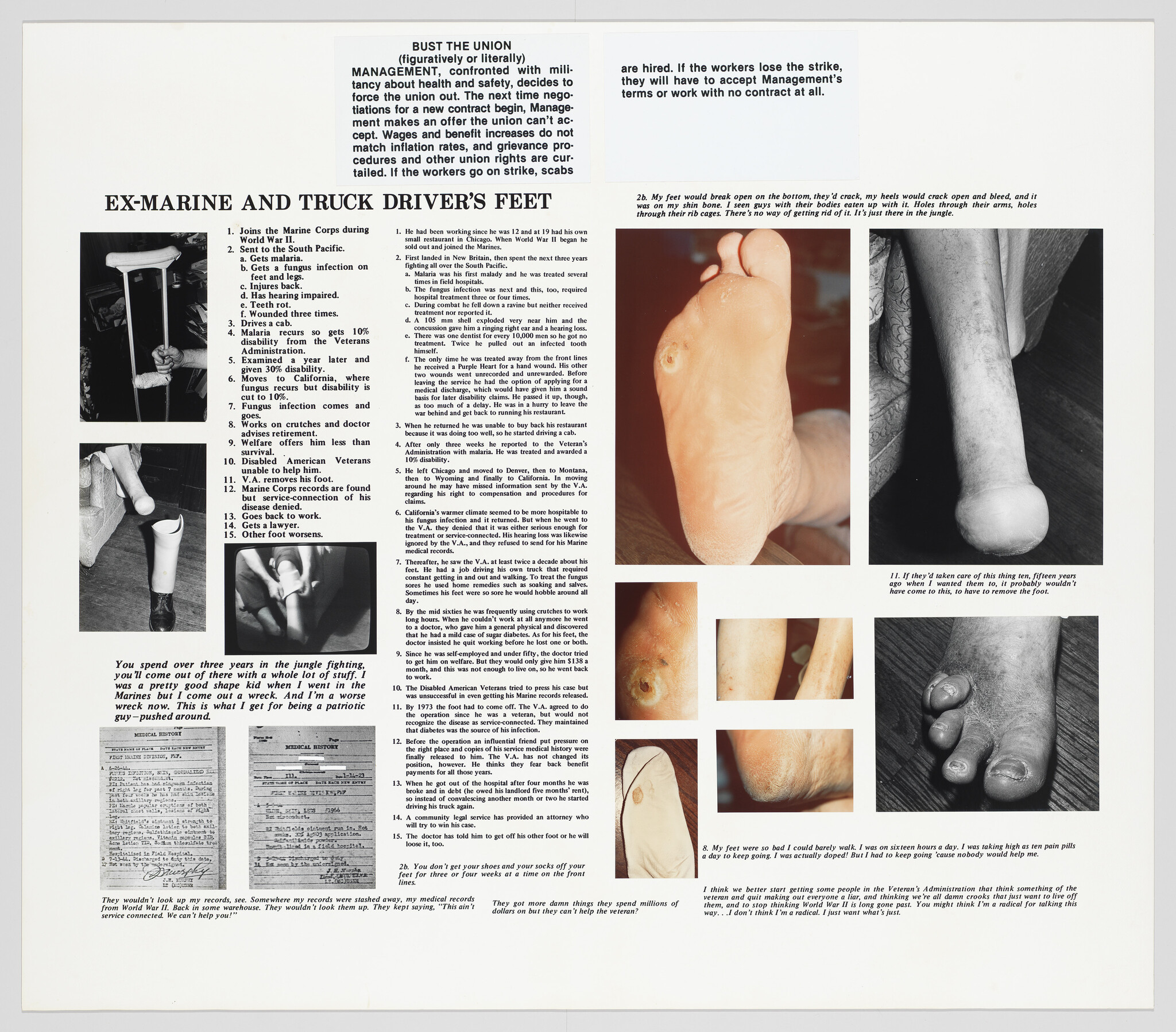 This image is a collage of text and photographs that appears to be an informational piece titled "EX-MARINE AND TRUCK DRIVER'S FEET." The left side of the image contains a list of points detailing an individual's journey from joining the Marine Corps to various hardships and medical issues related to their feet. The right side of the image features a series of black and white photographs showing close-ups of feet with visible ailments and deformities. The overall layout suggests a narrative or documentary style, possibly aiming to highlight the physical toll of certain professions or experiences.