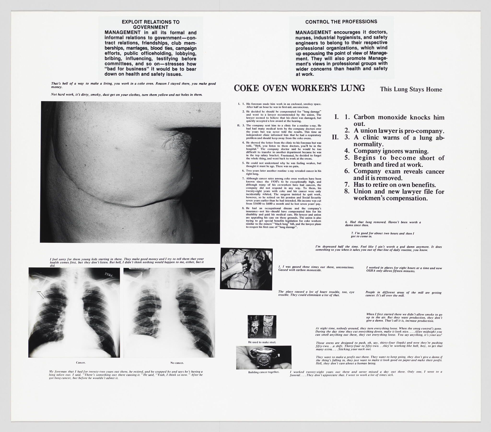 A collage of text and images related to occupational health, focusing on "Coke Oven Worker's Lung." The central image is a close-up of a person's torso showing a large scar, with X-ray images of lungs below. The surrounding text includes narratives, medical information, and steps of disease progression.