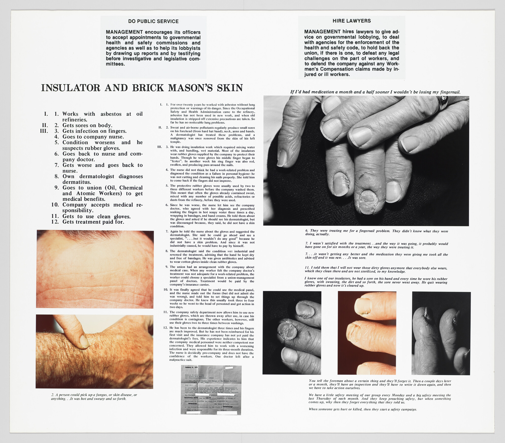 Poster showing a worker's damaged fingers and fingernails from asbestos-related skin conditions.