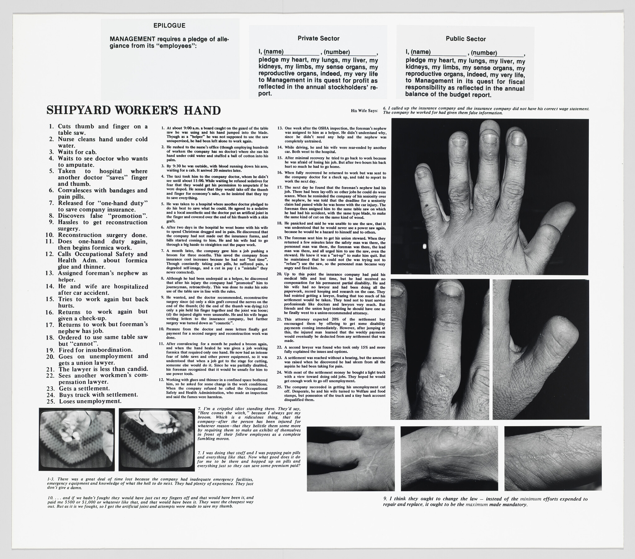 Large poster showing a shipyard worker's injured hand photos and a numbered account of the injury.