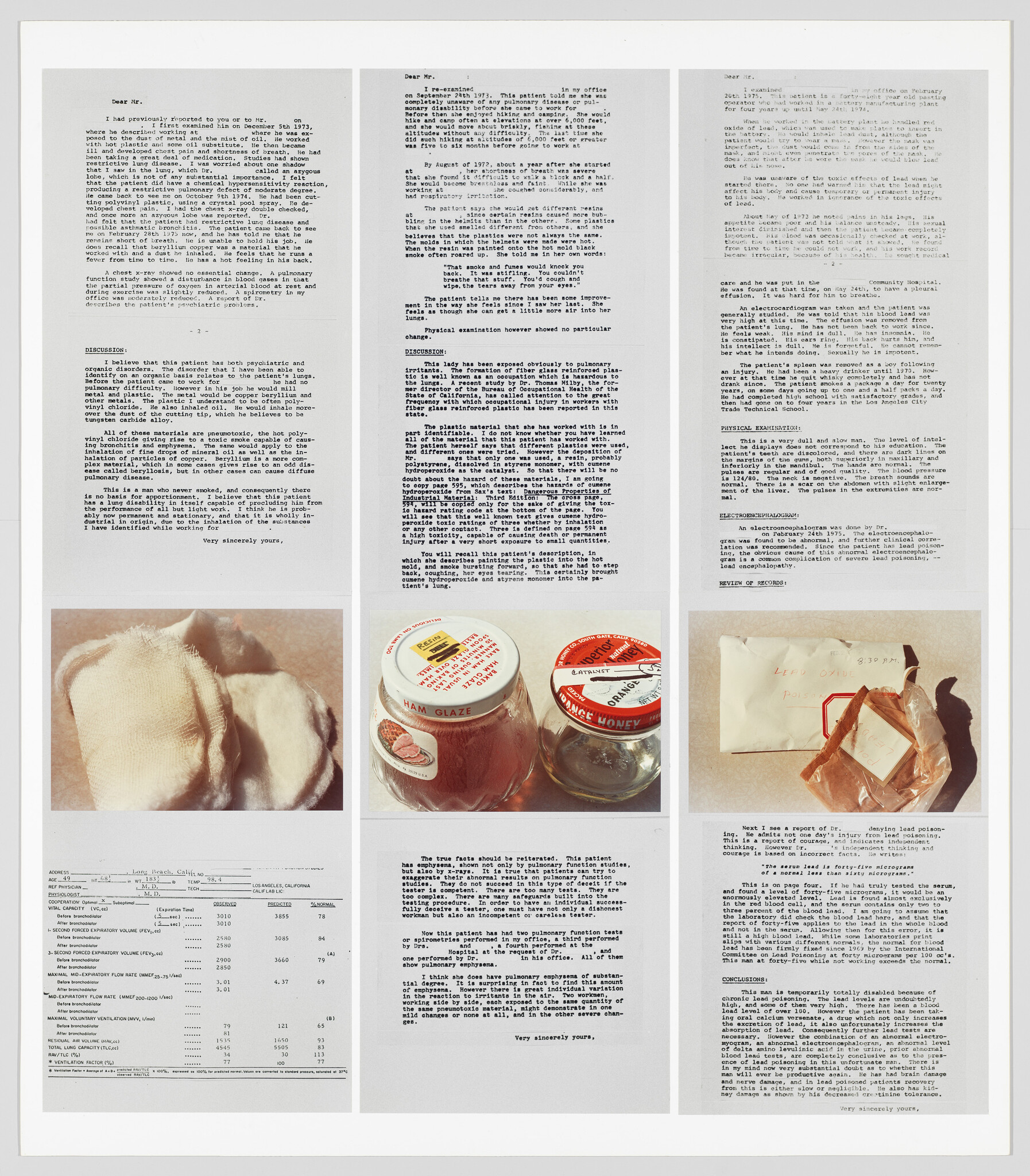 Three columns of typed reports above photos of cloth pads, glass jars, and an envelope with wrapped contents.