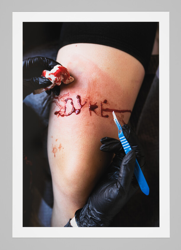Gloved hands holding a scalpel and bloody gauze beside a carved word on a leg.