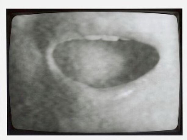 Close-up of an open mouth showing upper teeth and a rounded dark oral cavity.