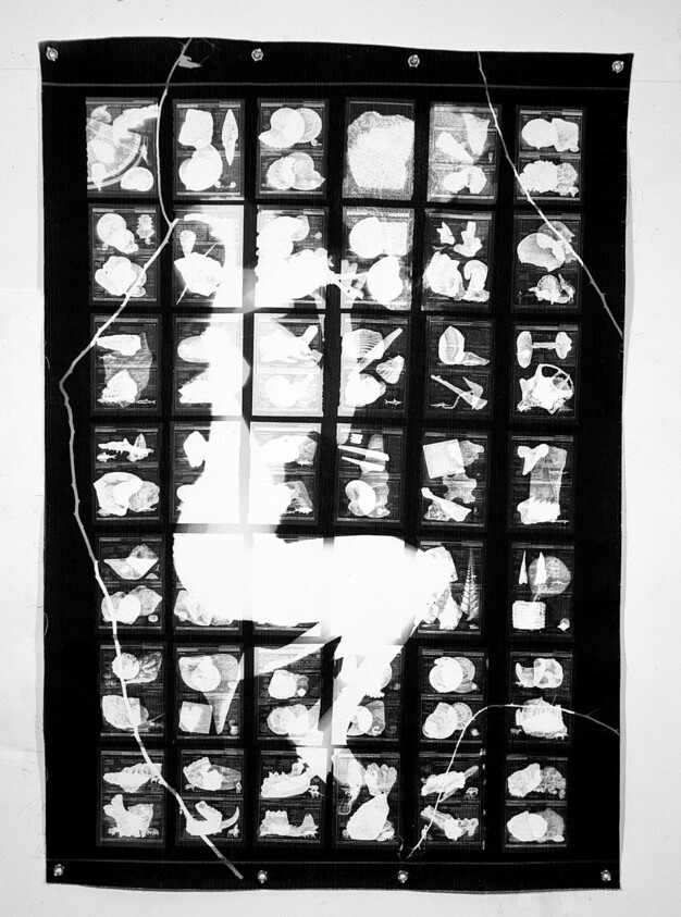 Grid of small X-ray images arranged on a black panel with a large white silhouette overlay.