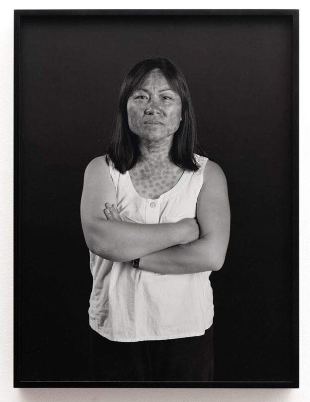 Woman with patterned skin stands with her arms crossed, looking directly at the camera.