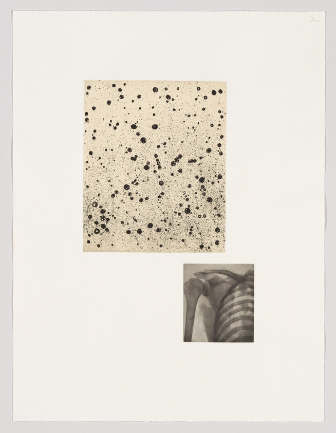 A piece of artwork featuring two square images on a white background. The larger square at the top displays a pattern of black speckles and dots scattered across a beige surface. Below and to the right, a smaller square shows a grayscale image of a human ribcage with a striped pattern overlay. The artist's signature is visible in the top right corner of the white background.