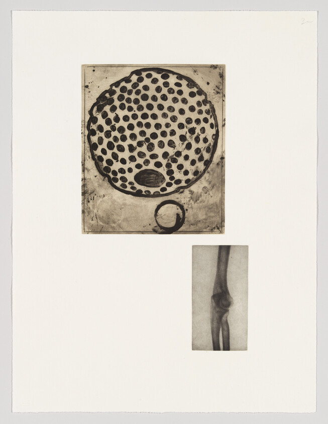 A print featuring two separate images on a white background: the top image is an abstract circular pattern with numerous black dots, and the bottom image is a grayscale depiction of a human leg bone structure, possibly an X-ray.