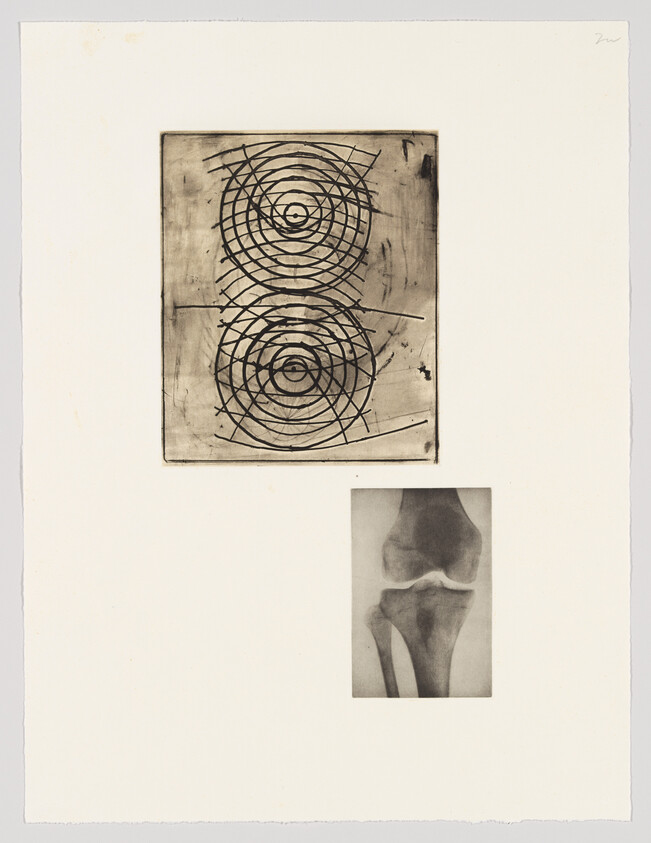 An artwork featuring two separate images on a white background. The top image is a square plate with concentric circular patterns resembling spirals, etched onto a dark, grungy surface. Below it, a smaller rectangular image shows an X-ray of a human knee joint. The artist's signature is visible in the top right corner of the white background.
