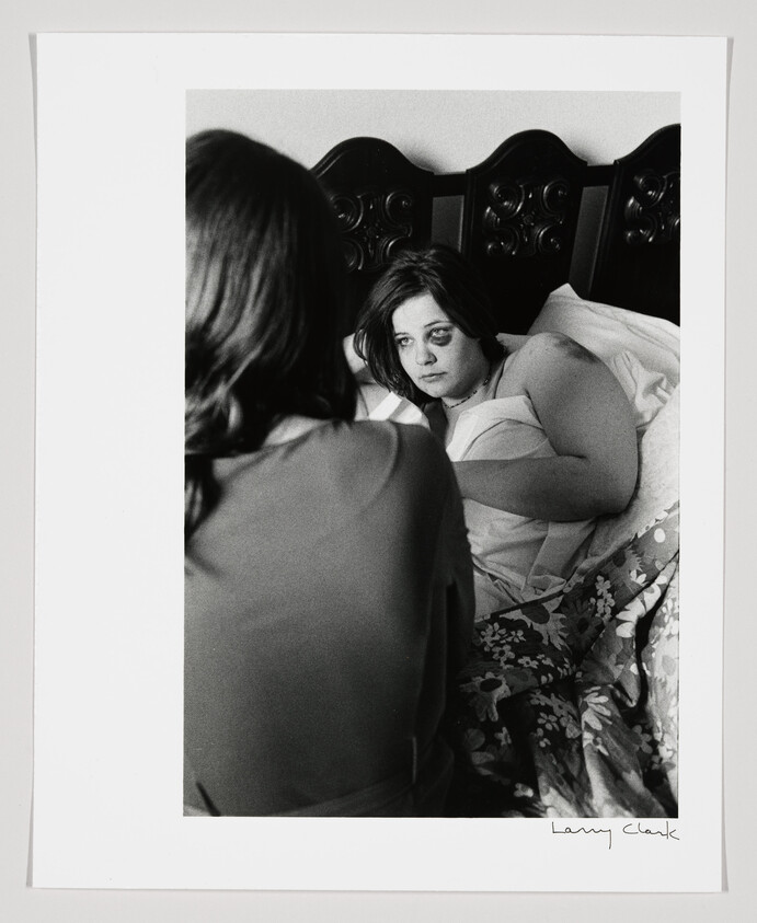 Woman with a bruised eye lies in bed while another person sits facing her.