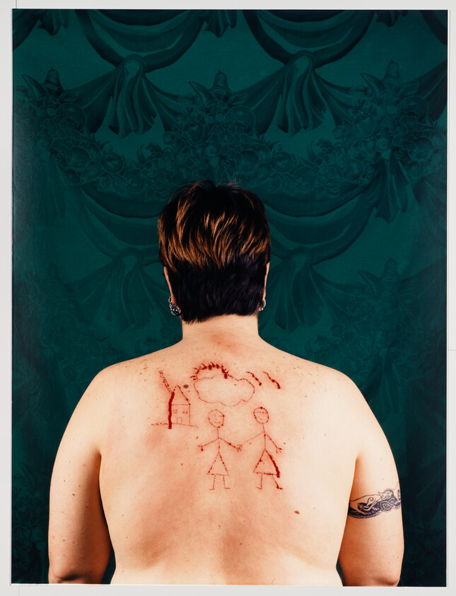 Person's bare back shows scarified stick-figure drawing of two people, a house, and a cloud.