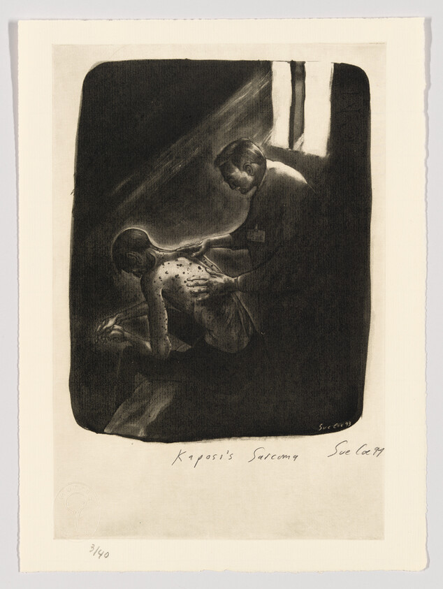 A black and white print depicting a medical scene with a patient and a healthcare professional. The patient is lying down with visible lesions on the skin, indicative of Kaposi's sarcoma, while the healthcare worker examines the affected area. The image has a dark, somber tone, and there is handwriting at the bottom that reads "Kaposi's Sarcoma" and "Sue Coe 89." There is also a stamp or seal in the lower left corner and a print number "31/40" indicating its edition.