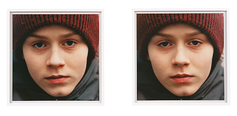 Two photographs of a person's face up close.