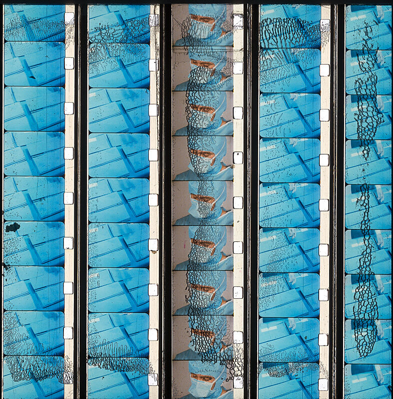 Photograph slides of blue shapes and a person wearing scrubs.