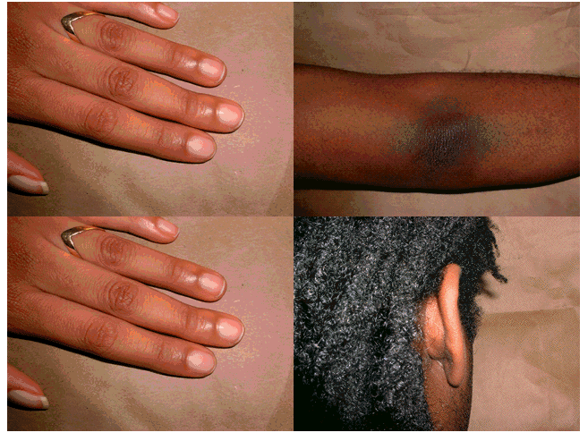 A grid of four images showing people's hands, elbows, and hair.