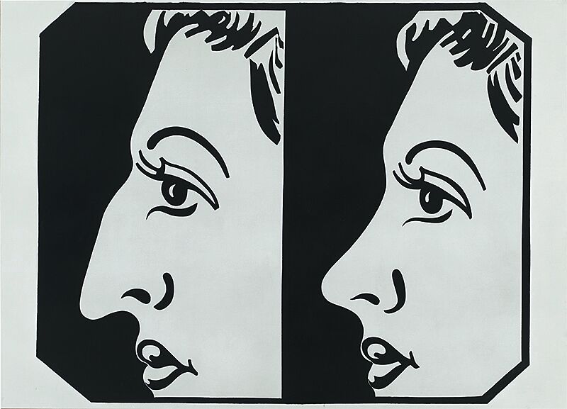 A drawing of a side profile of a woman before and after a nose surgery. 