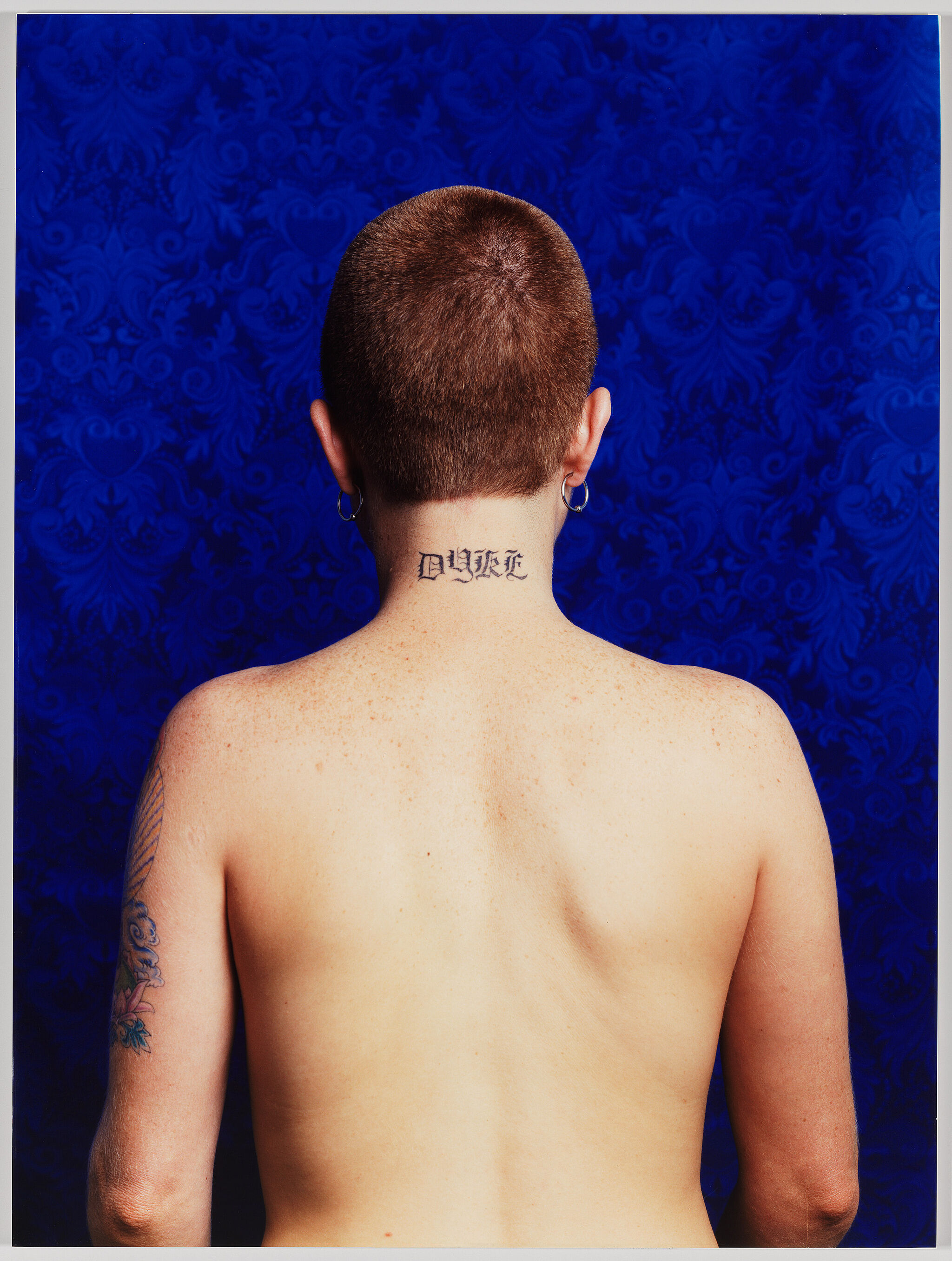 Photograph of a person's naked back.