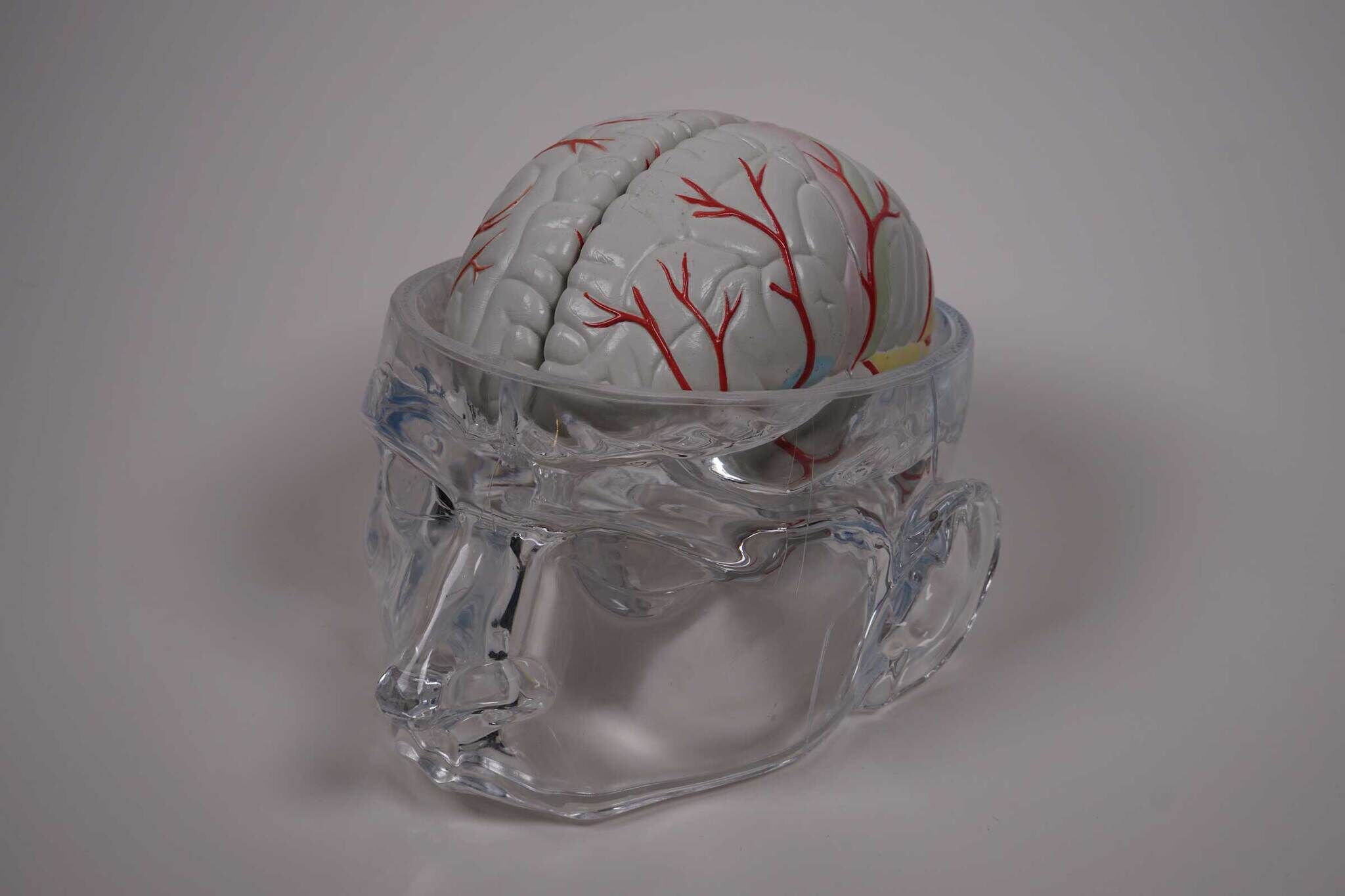 A transparent skull model with a white brain inside, showing red blood vessels on a grey background.