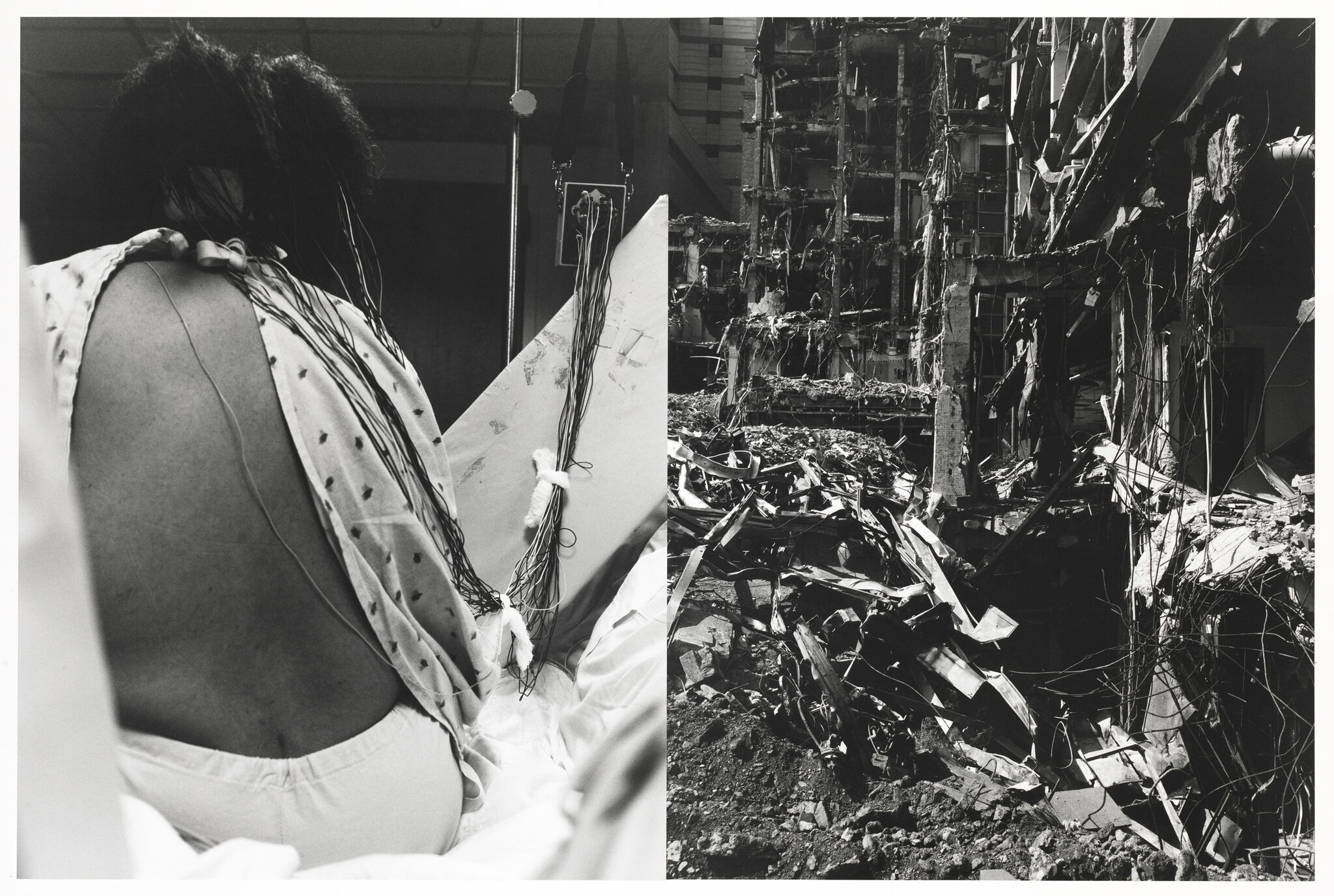 A person in a hospital gown with wires attached to their back sits beside a scene of building rubble and debris.